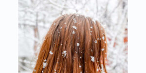 Lee más sobre el artículo Nieve y cuidado capilar: ¿cómo cuidar en pelo ante el frío extremo?