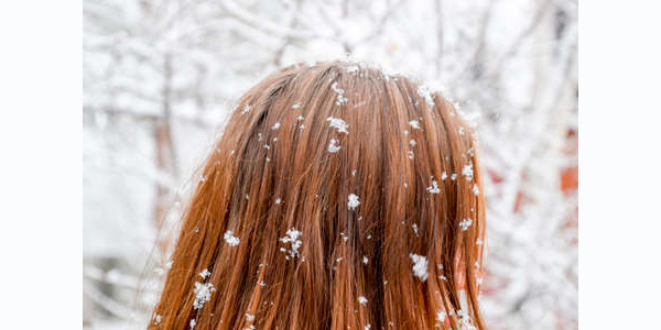 En este momento estás viendo Nieve y cuidado capilar: ¿cómo cuidar en pelo ante el frío extremo?